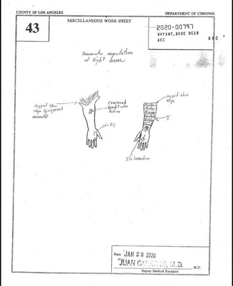 gigi.bryant autopsy|Kobe Bryant Autopsy Report Is Released After。